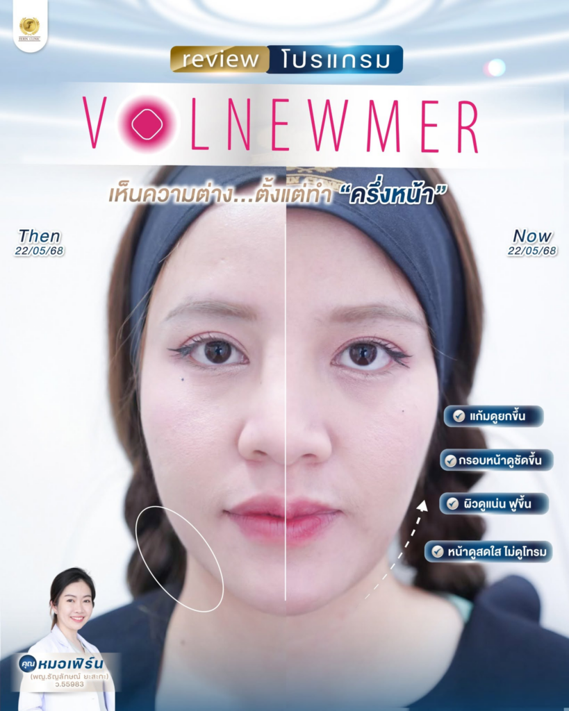 รีวิวคลินิกเสริมความงาม อุดรธานีที่ Ferin Clinic