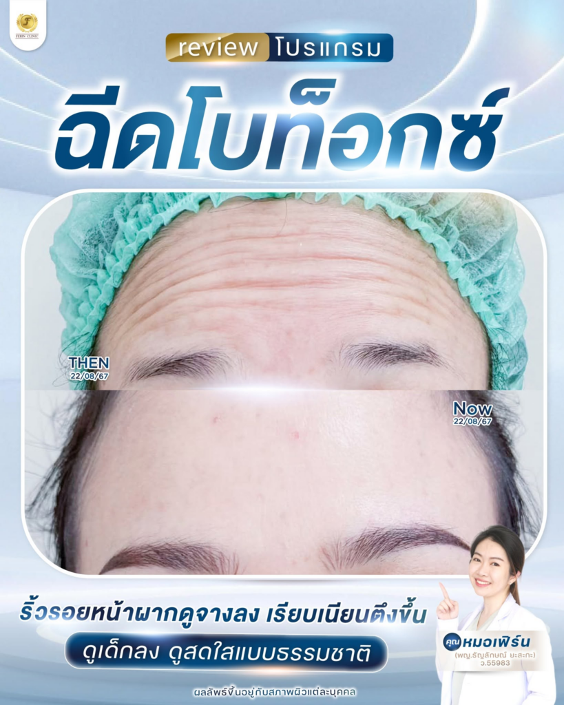 รีวิวคลินิกเสริมความงาม อุดรธานีที่ Ferin Clinic