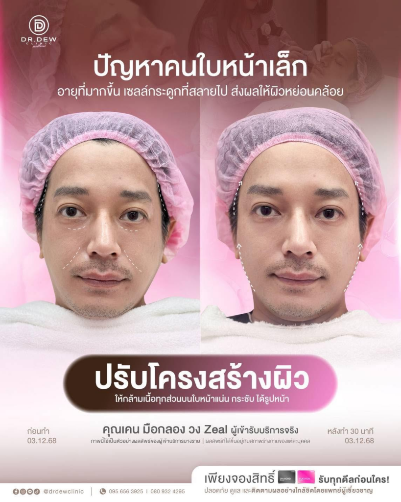 รีวิวคลินิกเสริมความงาม อุดรธานีที่ Dr.Dew Clinic
