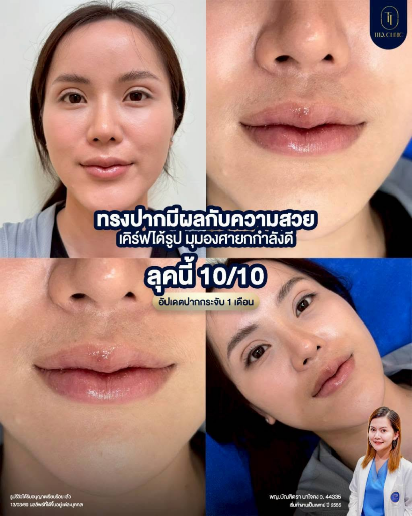 รีวิวคลินิกเสริมความงาม อุดรธานีที่ Tita Clinic