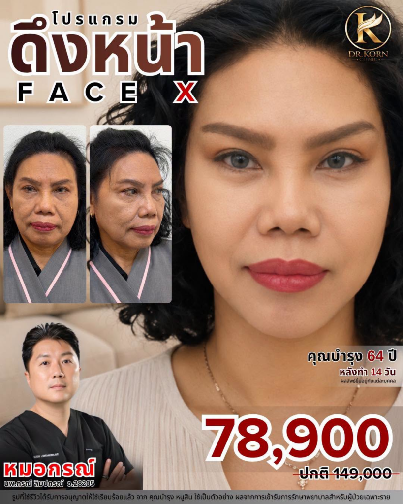 รีวิวคลินิกเสริมความงาม อุดรธานีที่ คลินิกหมอกรณ์