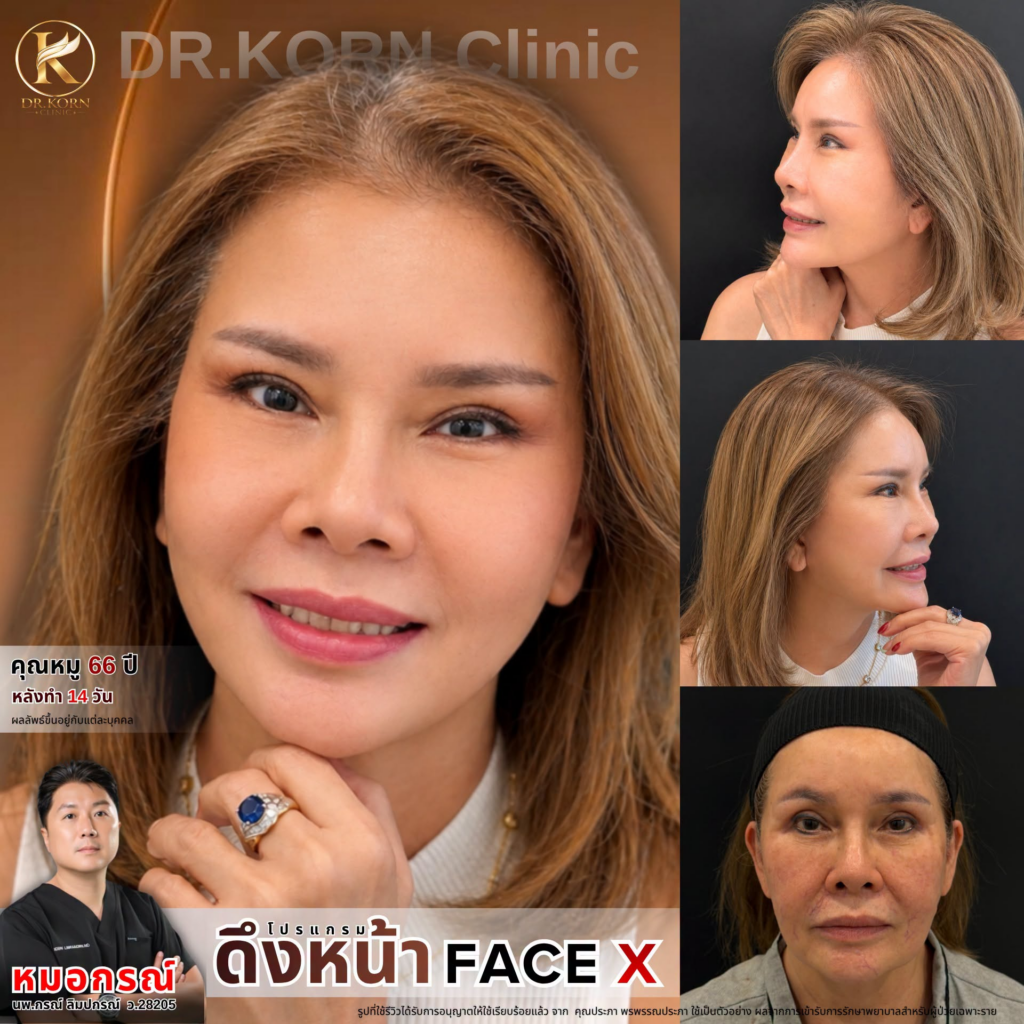 รีวิวคลินิกเสริมความงาม อุดรธานีที่ คลินิกหมอกรณ์
