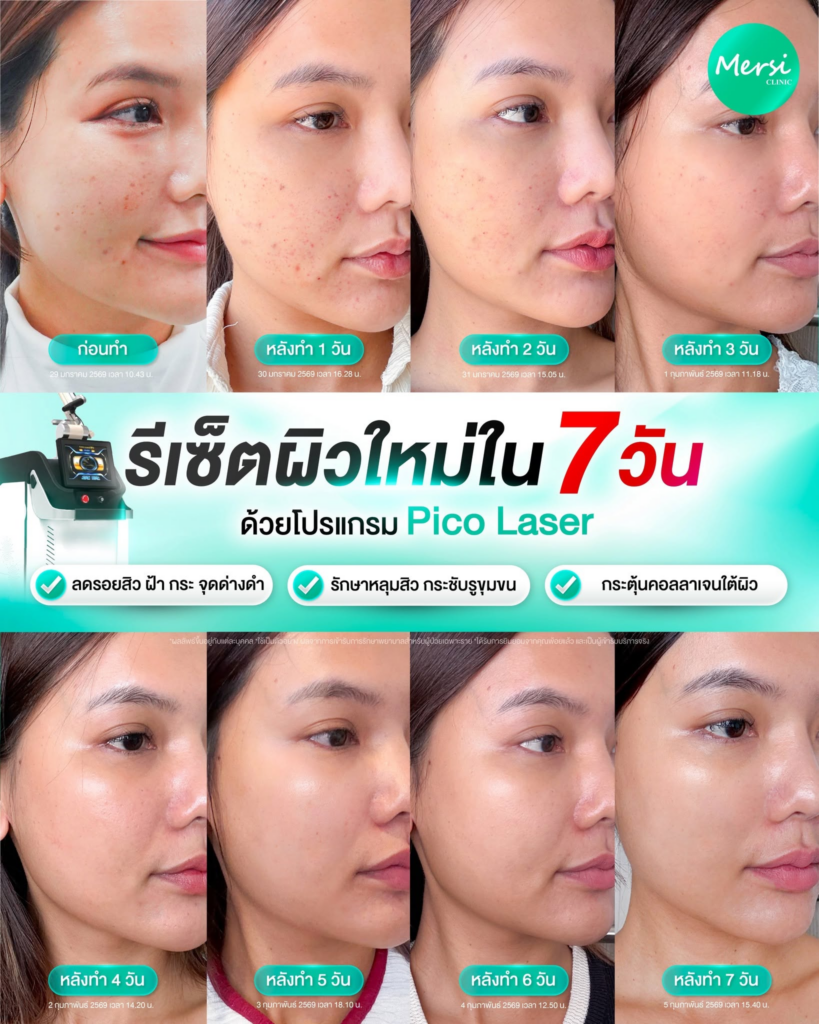 รีวิวคลินิกเสริมความงาม อุดรธานีที่ Mersi Clinic