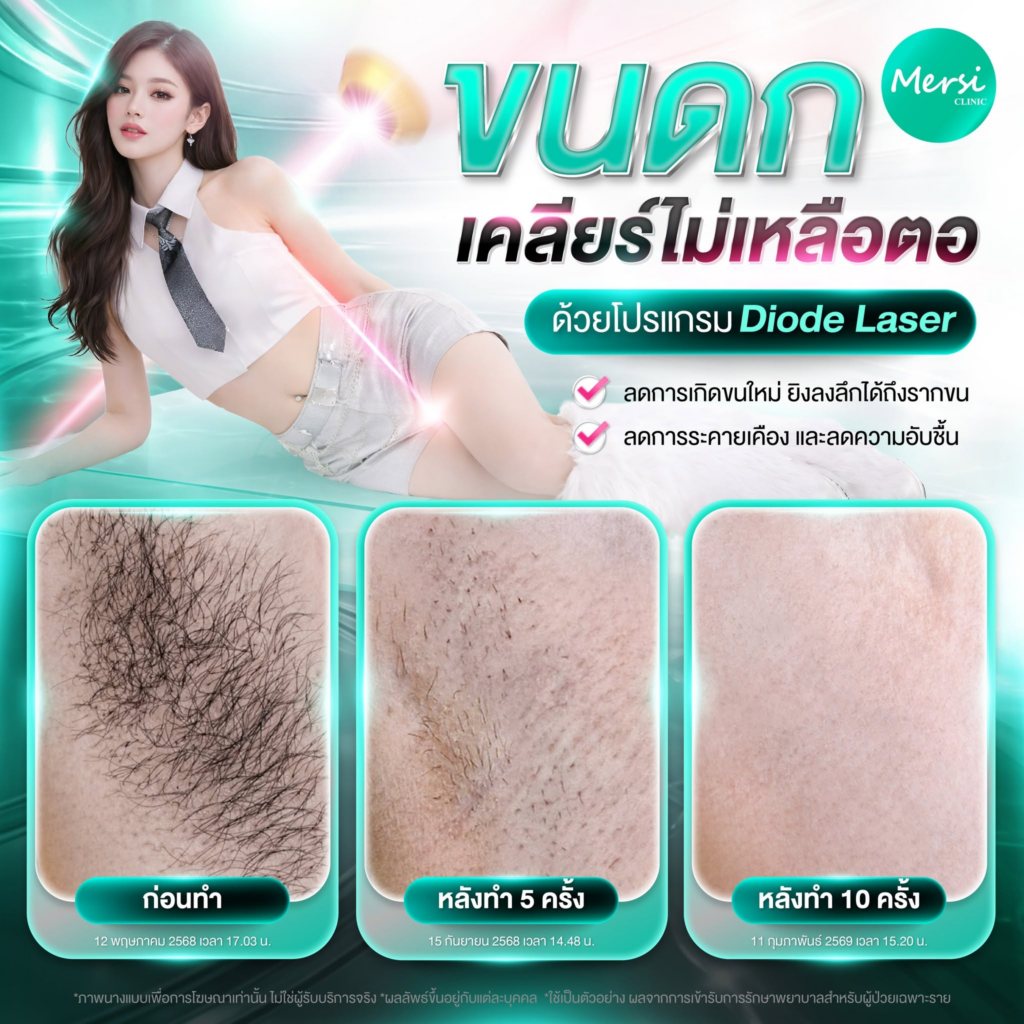รีวิวคลินิกเสริมความงาม อุดรธานีที่ Mersi Clinic