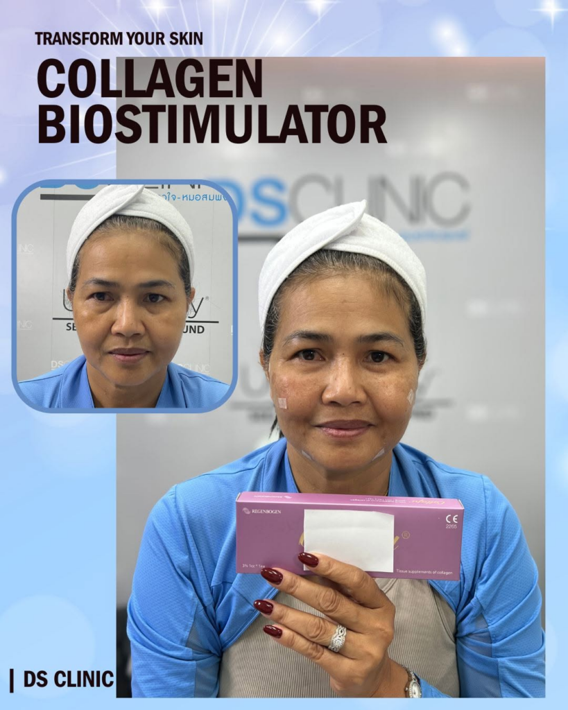 รีวิวคลินิกเสริมความงาม อุดรธานีที่ DS Clinic