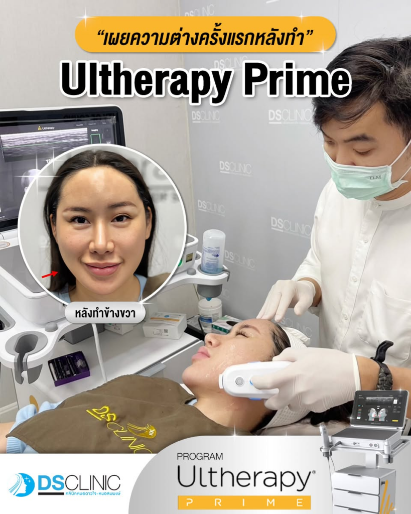 รีวิวคลินิกเสริมความงาม อุดรธานีที่ DS Clinic