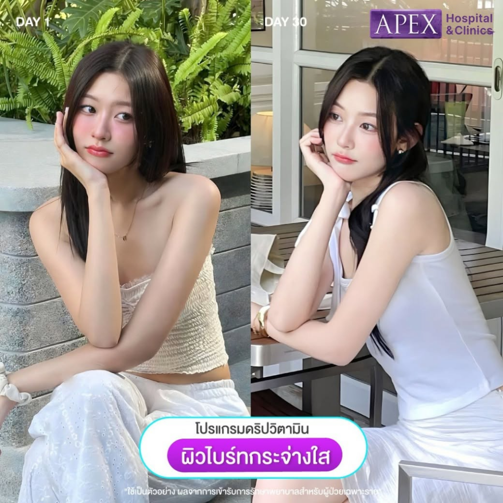 รีวิวคลินิกเสริมความงาม อุดรธานีที่ Apex Clinic สาขาอุดรธานี