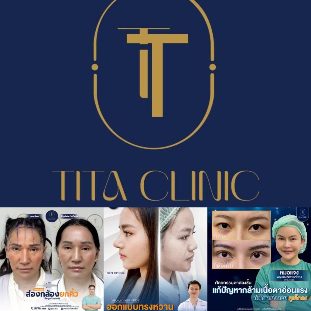 คลินิกเสริมความงาม อุดรธานีที่ Tita Clinic