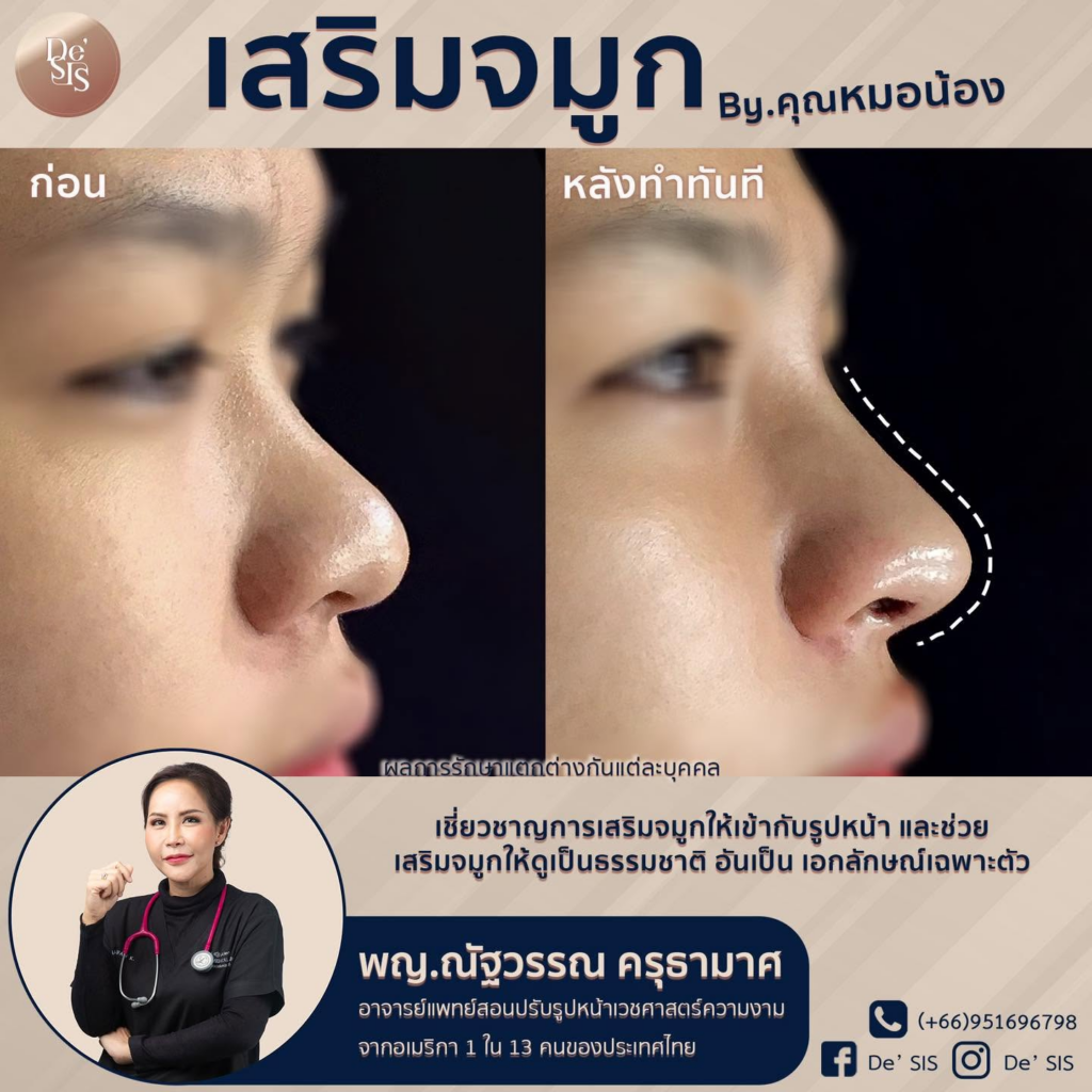 รีวิวคลินิกเสริมความงาม หนองคาย De'SIS Clinic