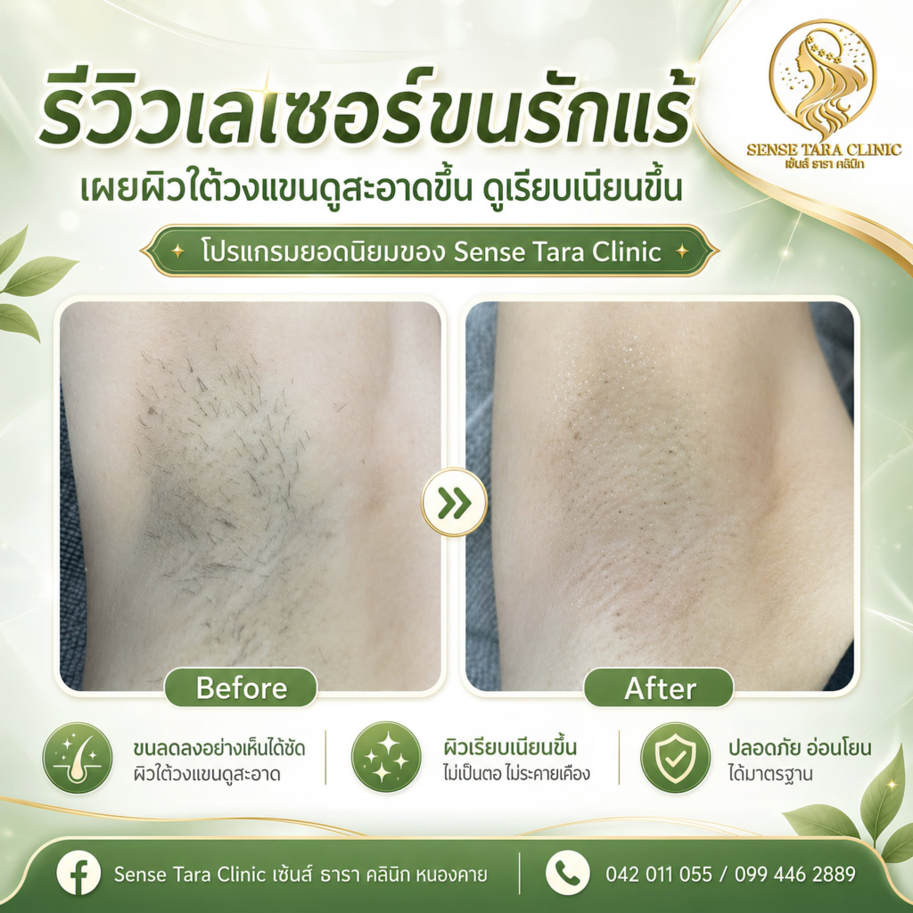 รีวิวคลินิกเสริมความงาม หนองคาย Sense Tara Clinic