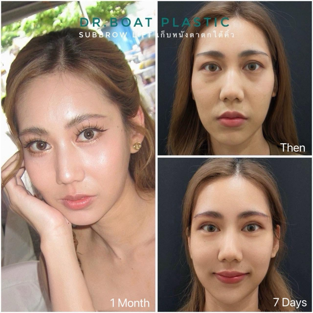 รีวิวคลินิกเสริมความงาม หนองคาย Dr. Boat Clinic