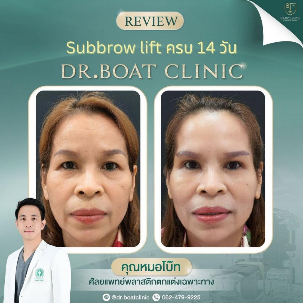 รีวิวคลินิกเสริมความงาม หนองคาย Dr. Boat Clinic