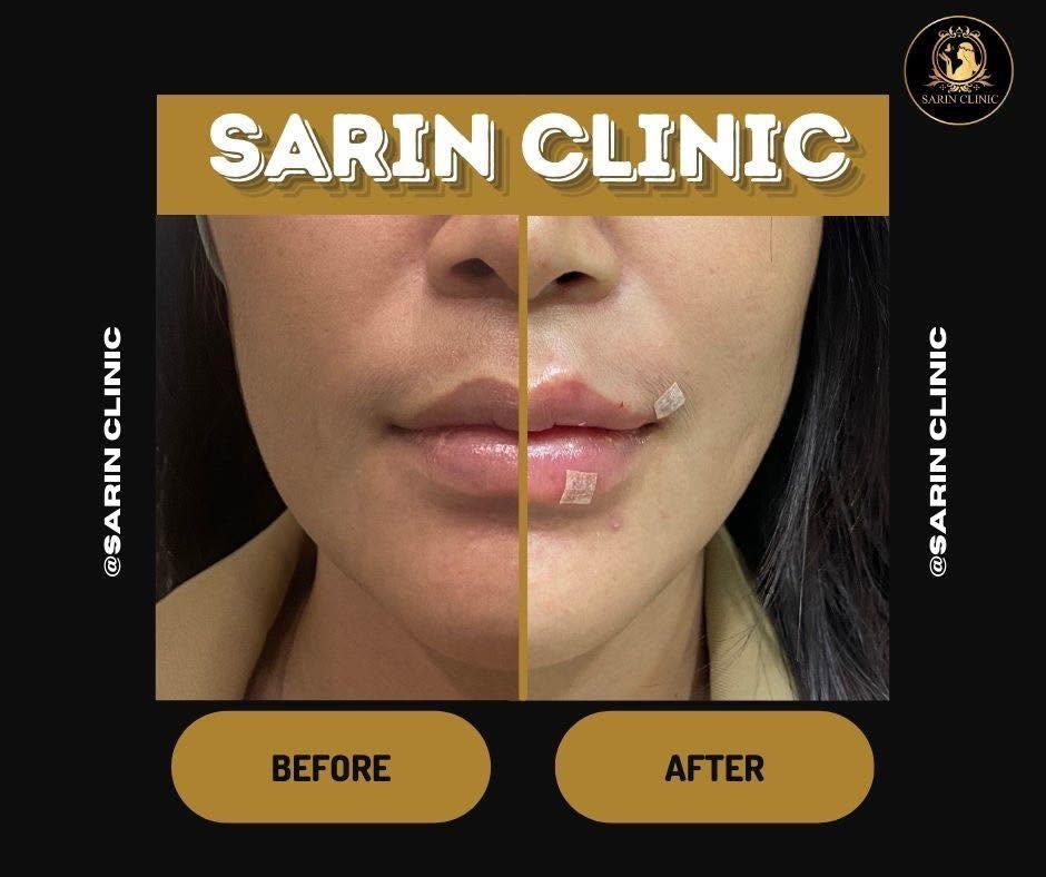 รีวิวคลินิกเสริมความงาม สุรินทร์ที่ Sarin Clinic