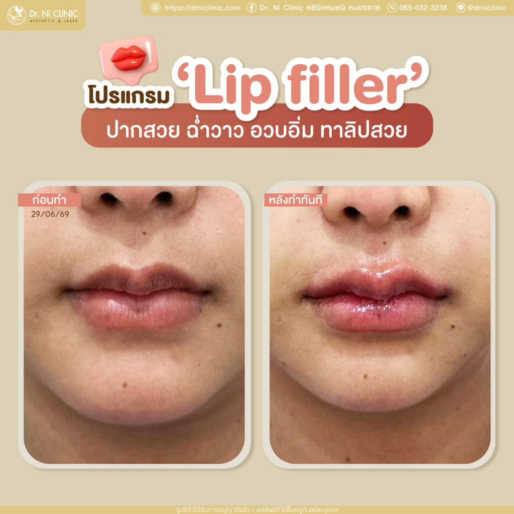 รีวิวคลินิกเสริมความงาม หนองคาย Dr. Ni Clinic