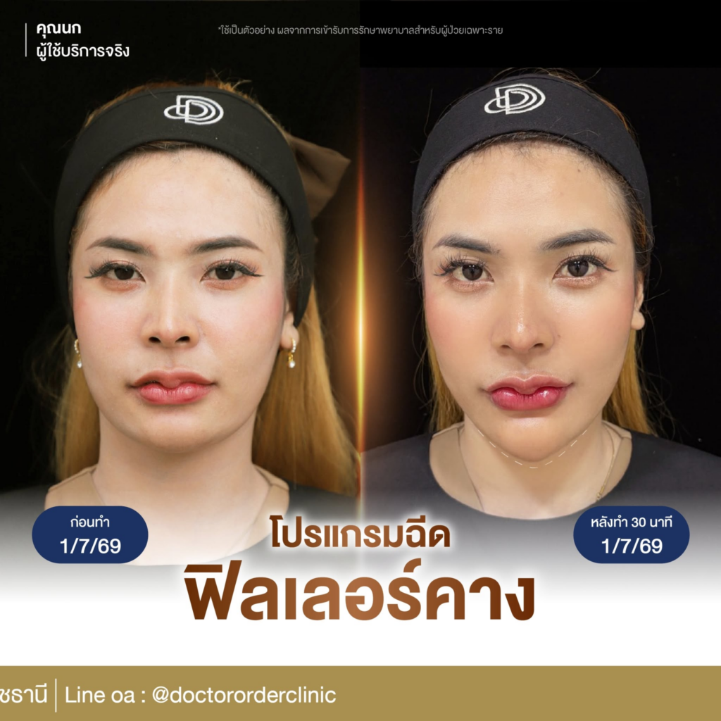 รีวิวคลินิกเสริมความงาม สุรินทร์ที่ Doctor Order Clinic
