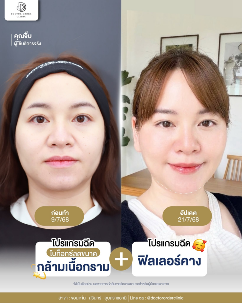 รีวิวคลินิกเสริมความงาม สุรินทร์ที่ Doctor Order Clinic