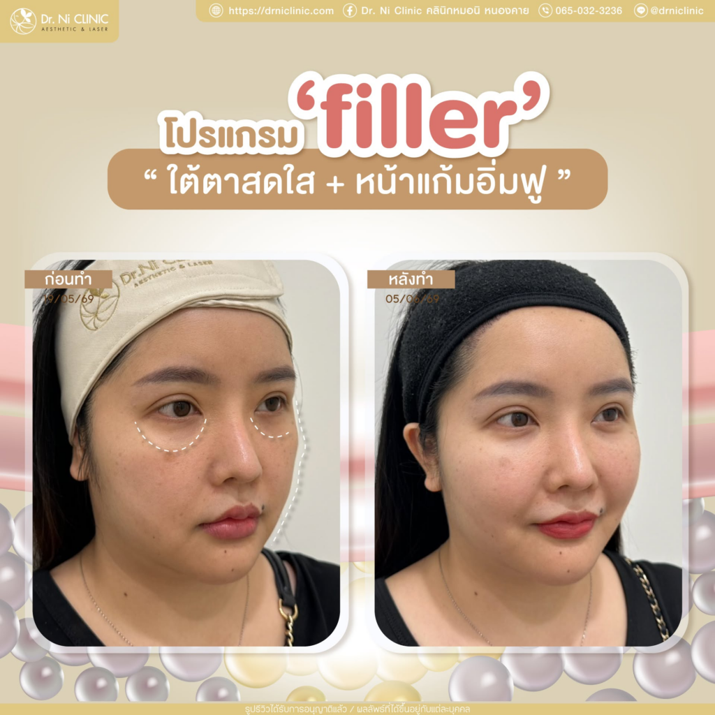 รีวิวคลินิกเสริมความงาม หนองคาย Dr. Ni Clinic