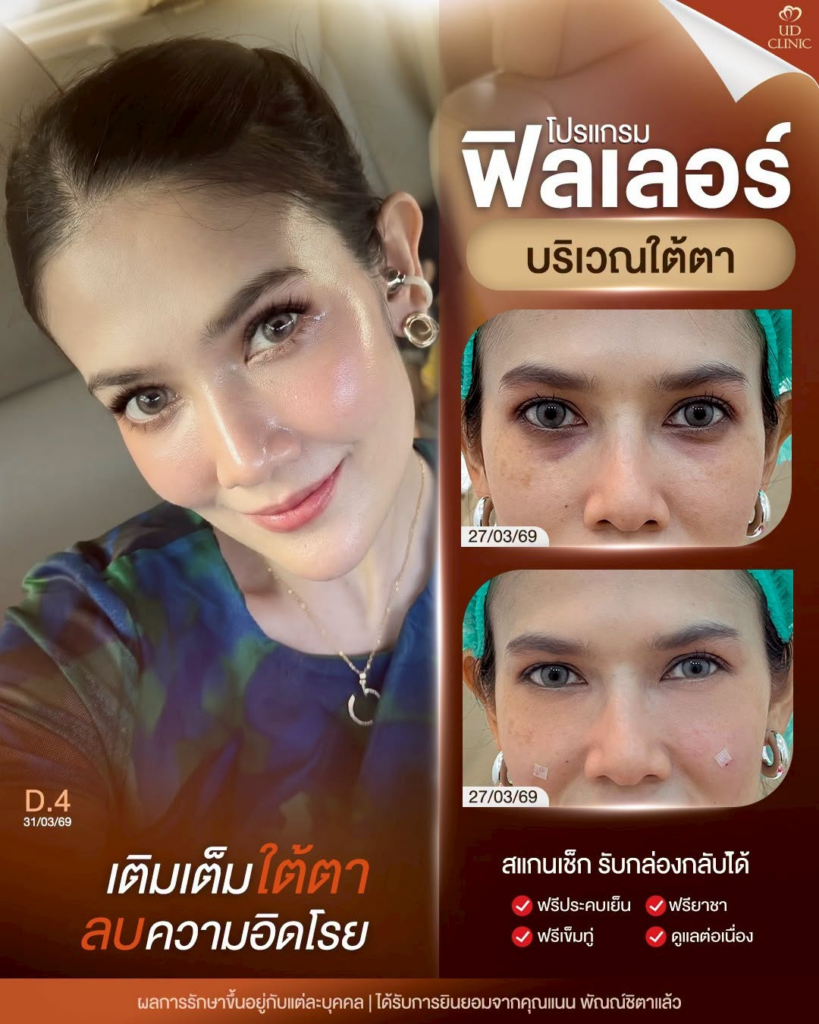 รีวิวคลินิกเสริมความงาม มหาสารคาม UD Clinic