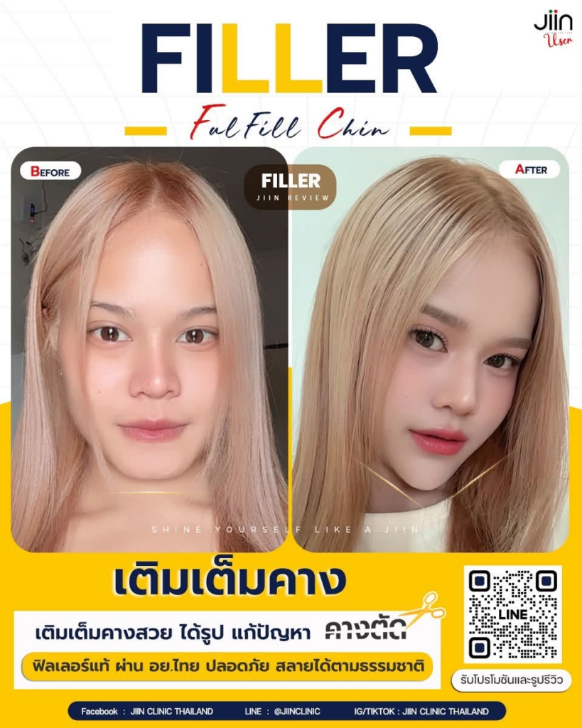 รีวิวคลินิกเสริมความงาม มหาสารคาม JIIN CLINIC