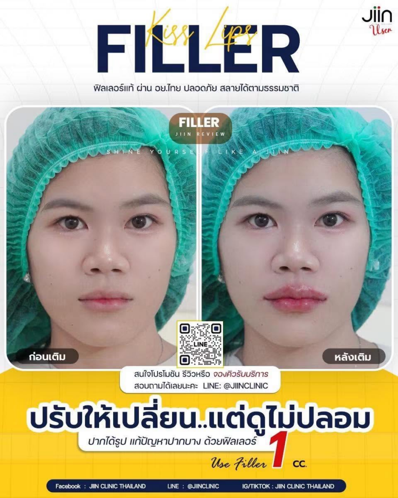 รีวิวคลินิกเสริมความงาม มหาสารคาม JIIN CLINIC