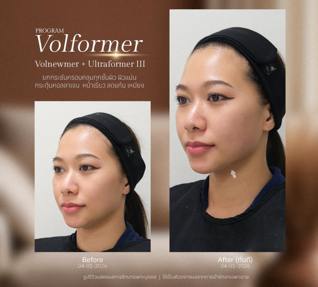 รีวิวคลินิกเสริมความงาม มหาสารคาม Gable Clinic