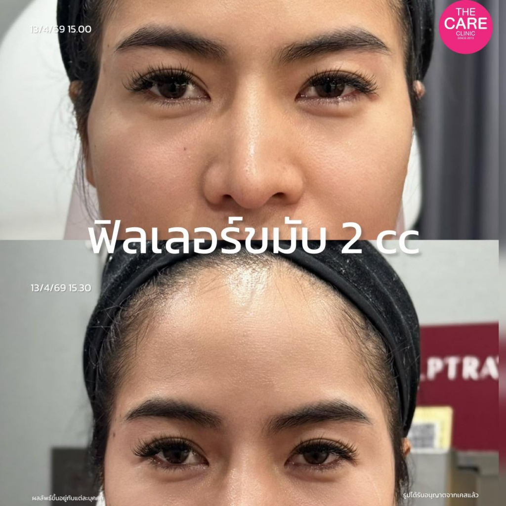 รีวิวคลินิกเสริมความงาม มหาสารคาม เดอะแคร์คลินิก