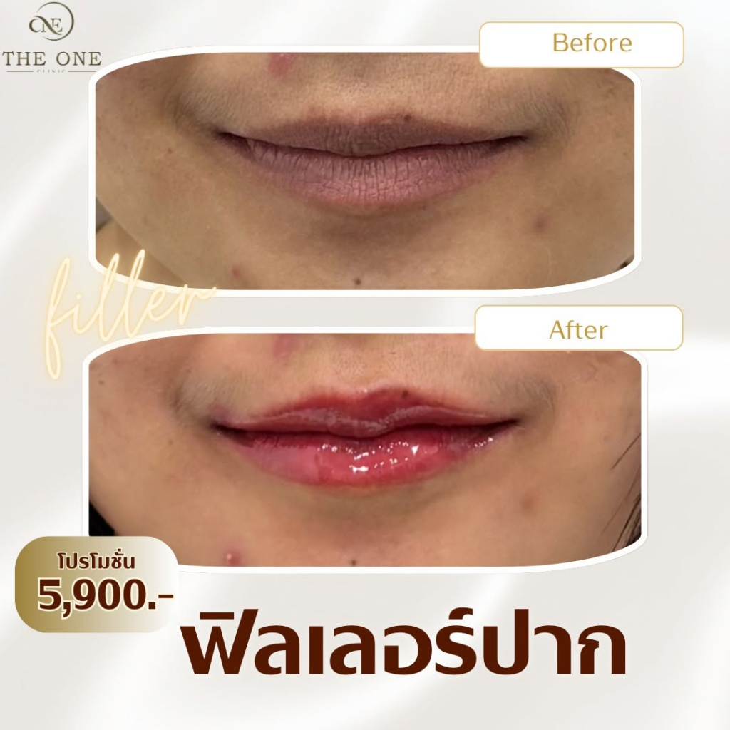 รีวิวคลินิกเสริมความงาม หนองคาย The One Clinic