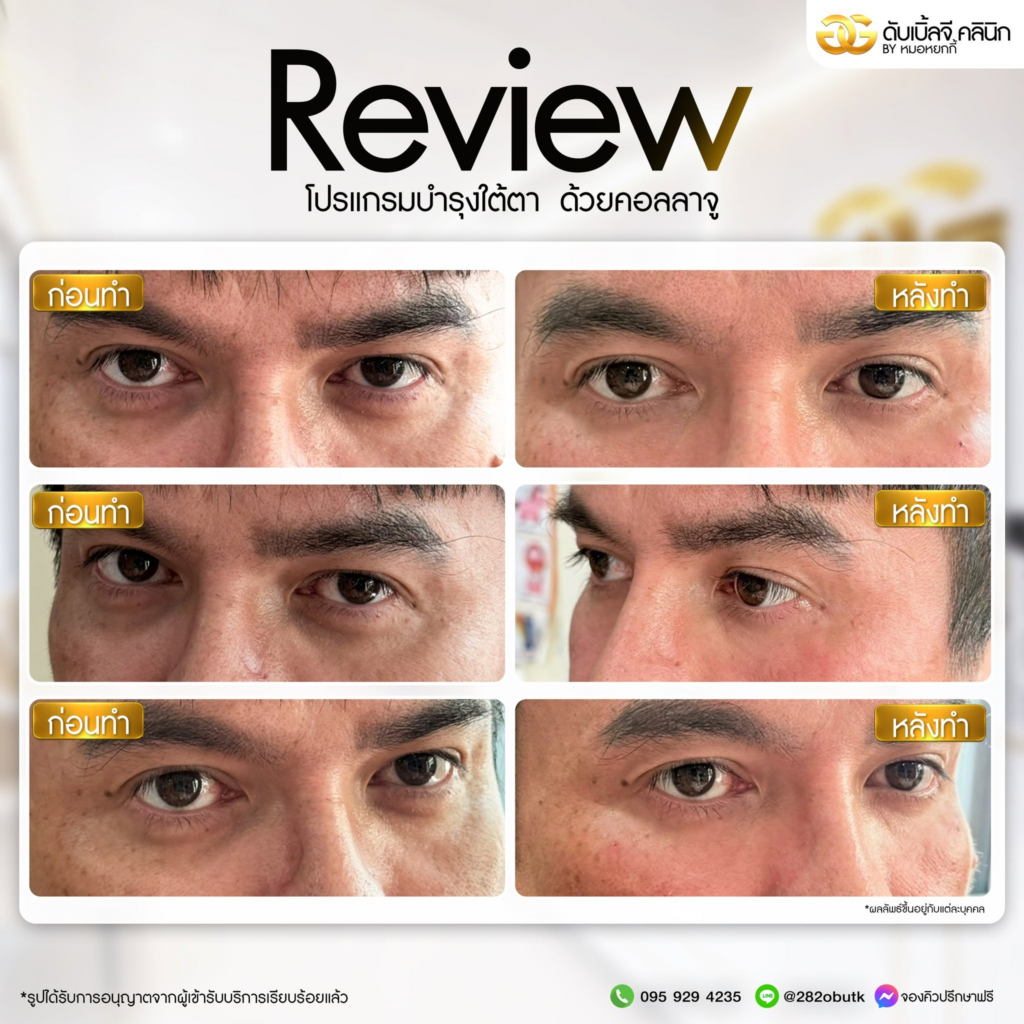 รีวิวคลินิกเสริมความงาม มหาสารคาม ดับเบิ้ลจีคลินิก
