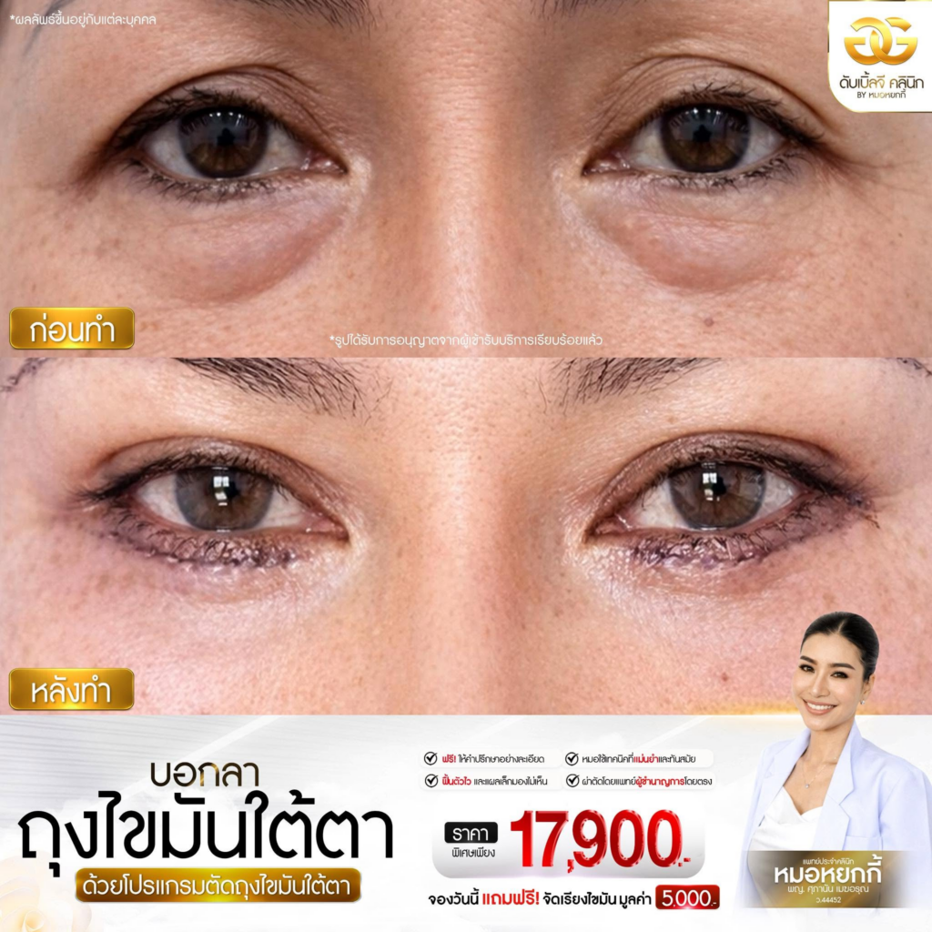รีวิวคลินิกเสริมความงาม มหาสารคาม ดับเบิ้ลจีคลินิก