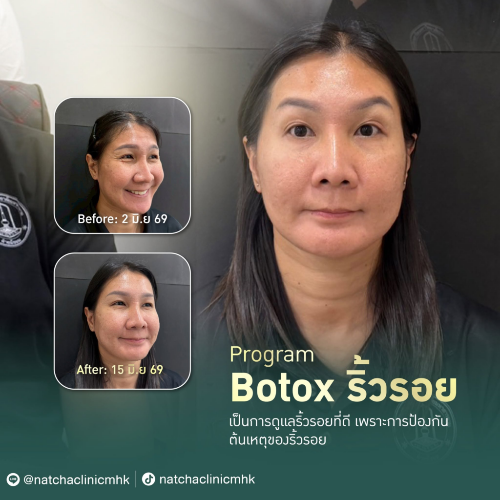  รีวิวคลินิกเสริมความงาม มหาสารคาม Natcha clinic