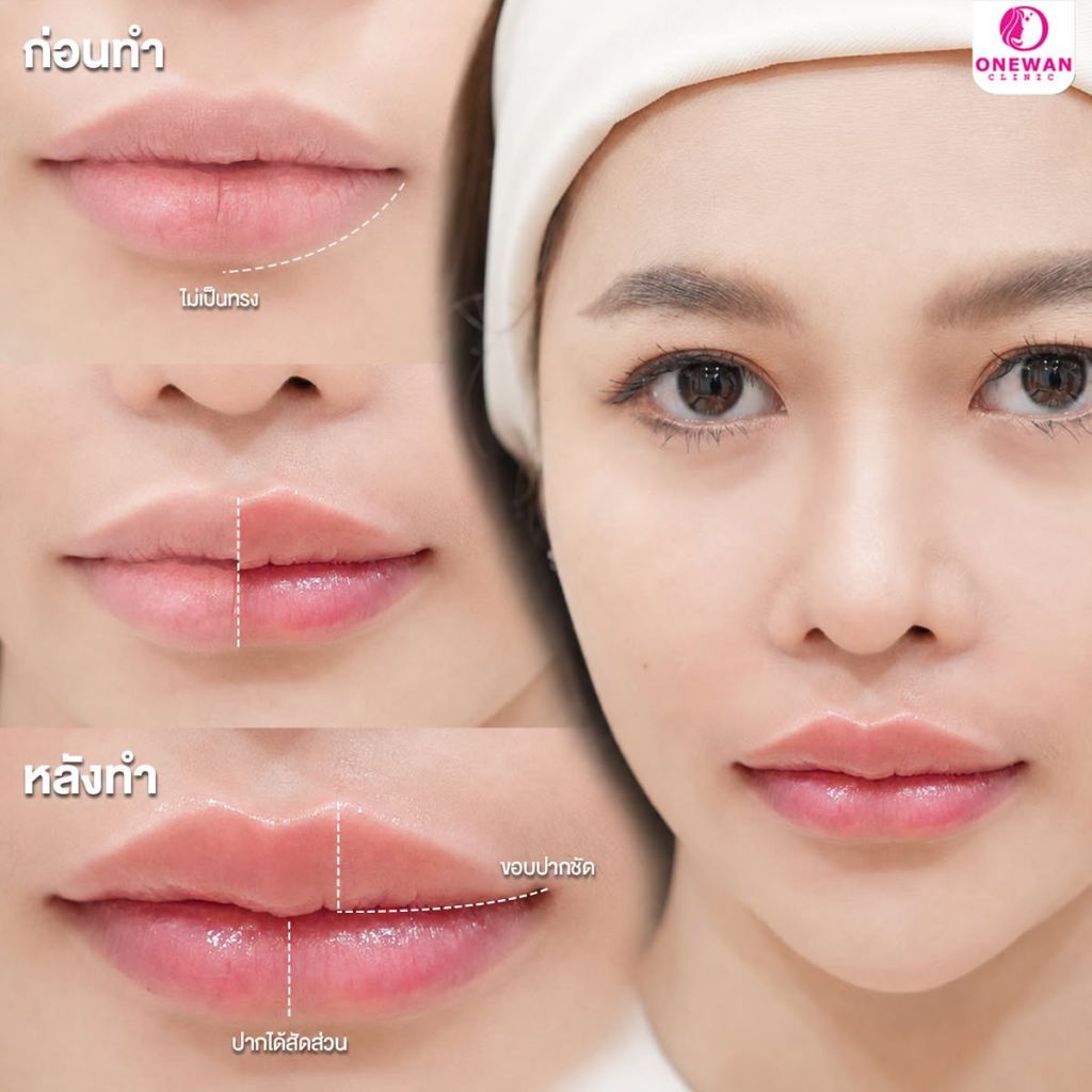 รีวิวคลินิกเสริมความงามบุรีรัมย์ที่ Onewan Clinic by Dr.Fronk