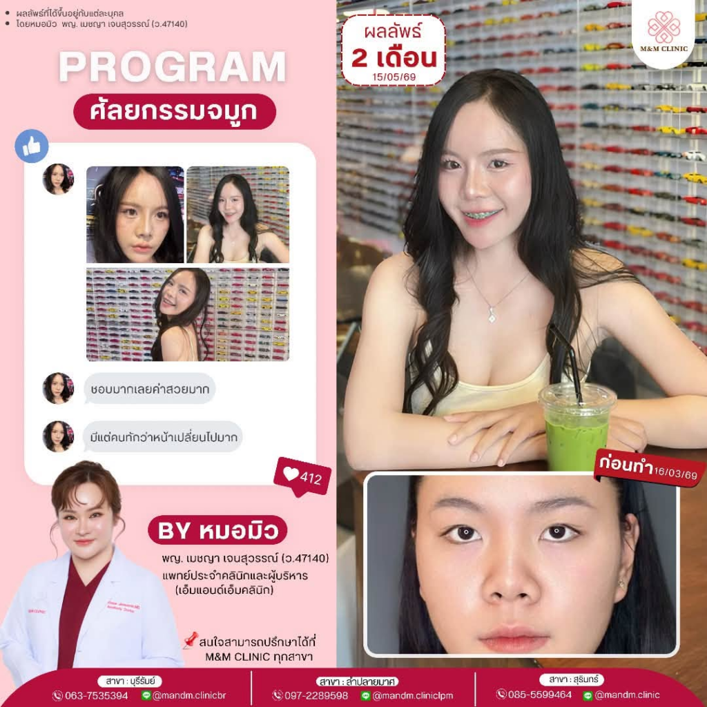 รีวิวคลินิกเสริมความงามบุรีรัมย์ที่ M&M Clinic by คุณหมอมิว