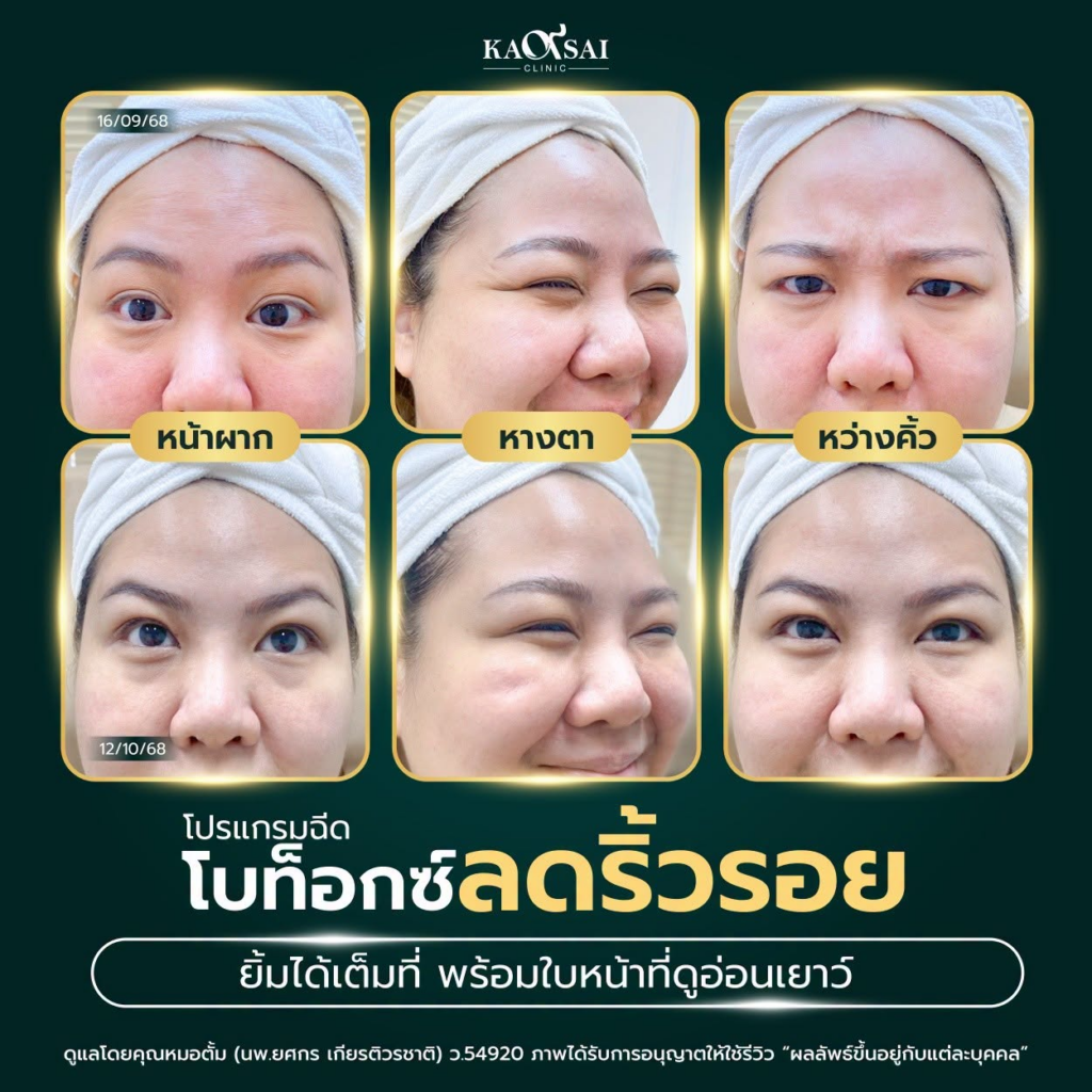 รีวิวคลินิกเสริมความงามบุรีรัมย์ที่ ก้าวใส คลินิก