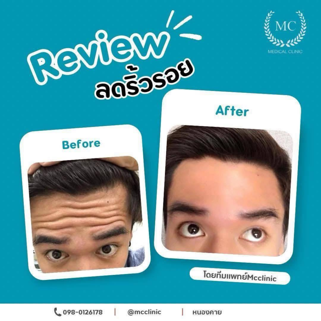 รีวิวคลินิกเสริมความงาม หนองคาย MC Medical Clinic