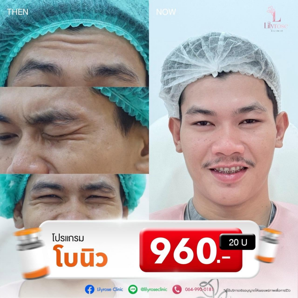 รีวิวคลินิกเสริมความงามบุรีรัมย์ที่ Lilyrose Clinic