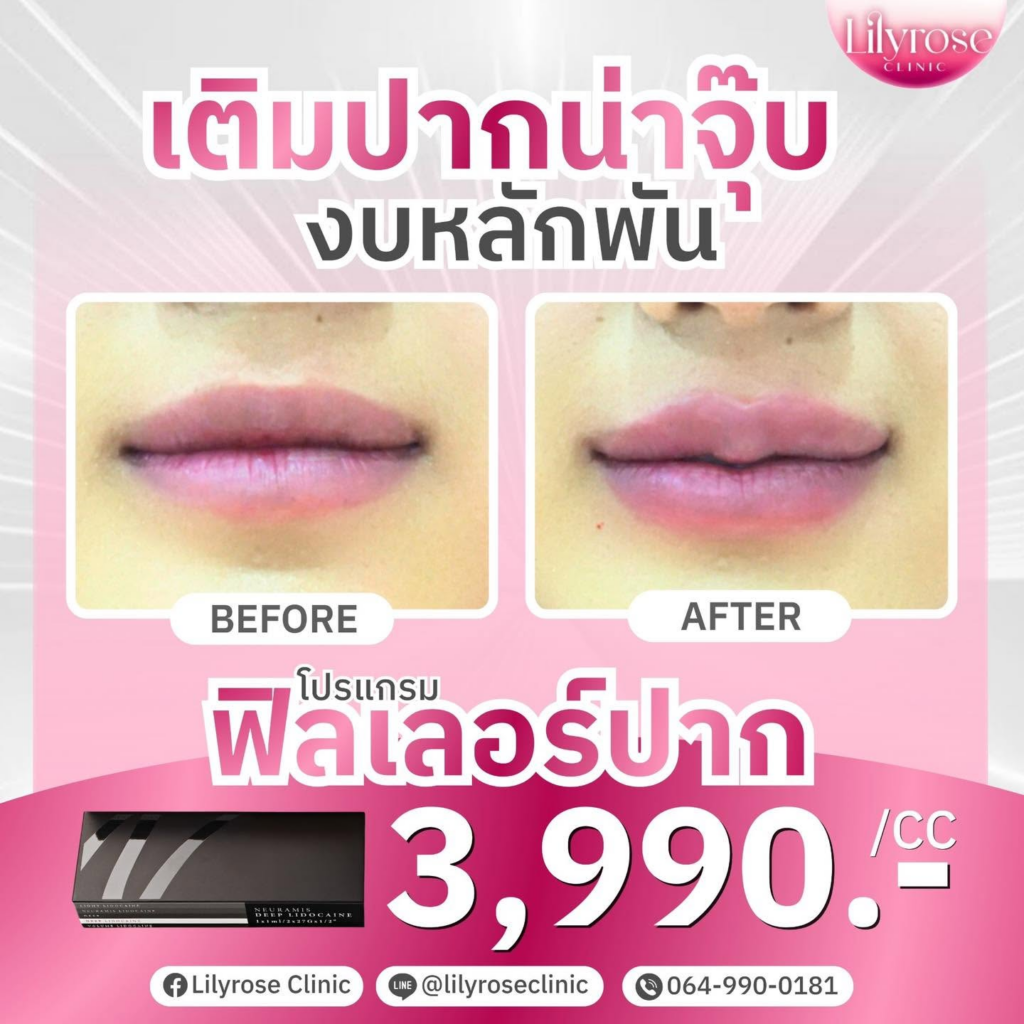 รีวิวคลินิกเสริมความงามบุรีรัมย์ที่ Lilyrose Clinic