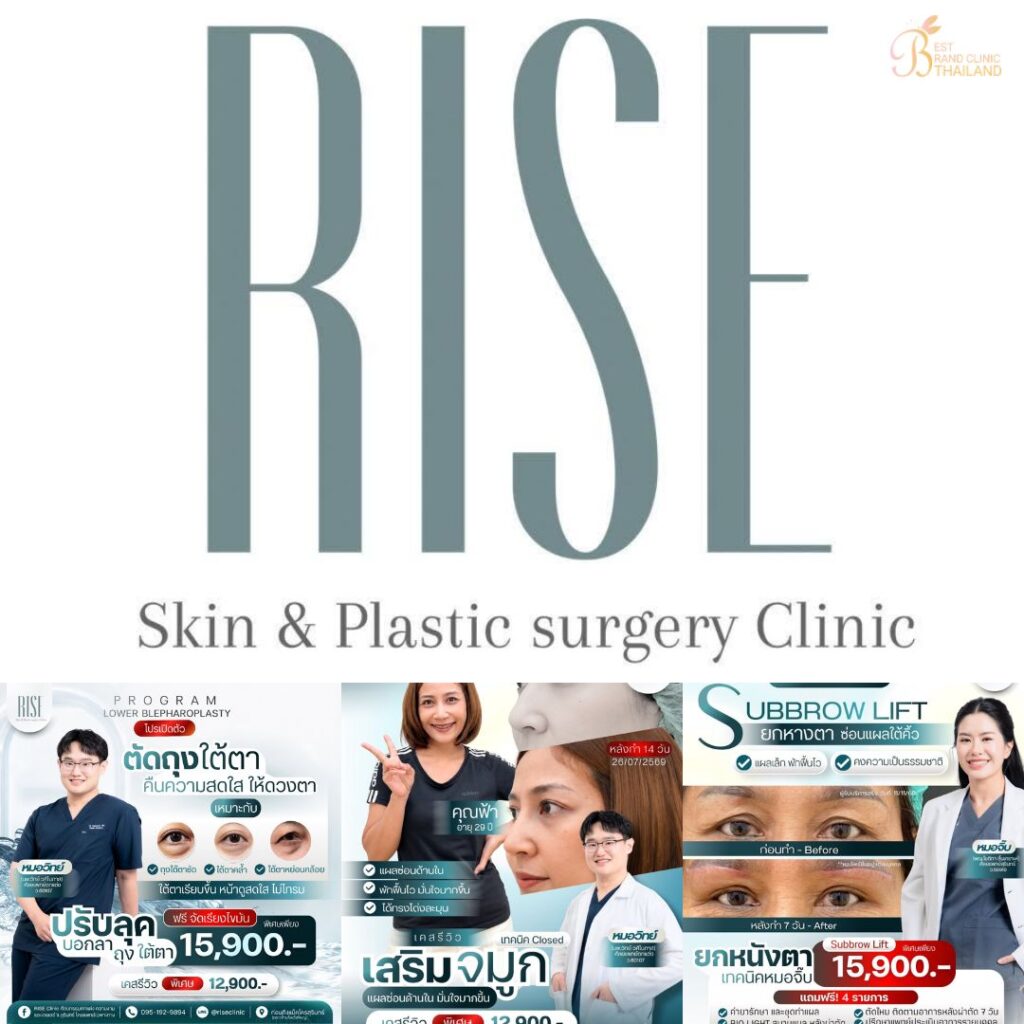 คลินิกเสริมความงาม สุรินทร์ที่ RISE Clinic