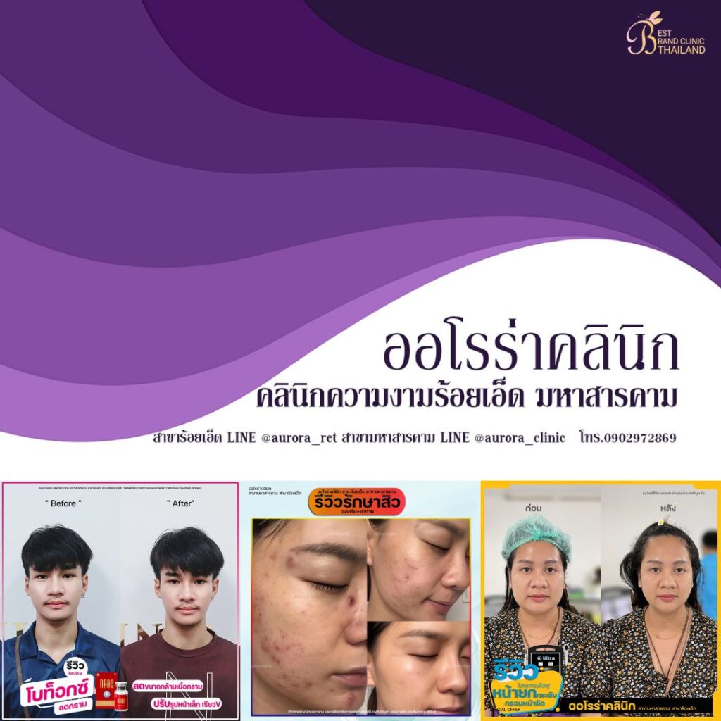 คลินิกเสริมความงาม ร้อยเอ็ดที่ AURORA CLINIC