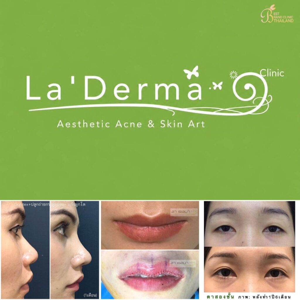 คลินิกเสริมความงาม มหาสารคาม ลาเดอมา คลินิก Art & Surgery