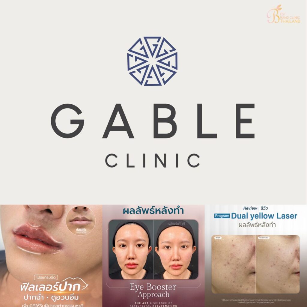 คลินิกเสริมความงาม มหาสารคาม Gable Clinic