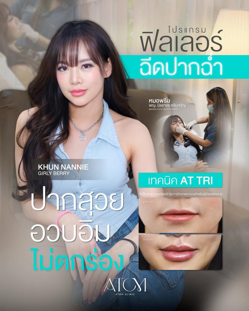 รีวิวฉีดฟิลเลอร์ปากที่ Atom Clinic