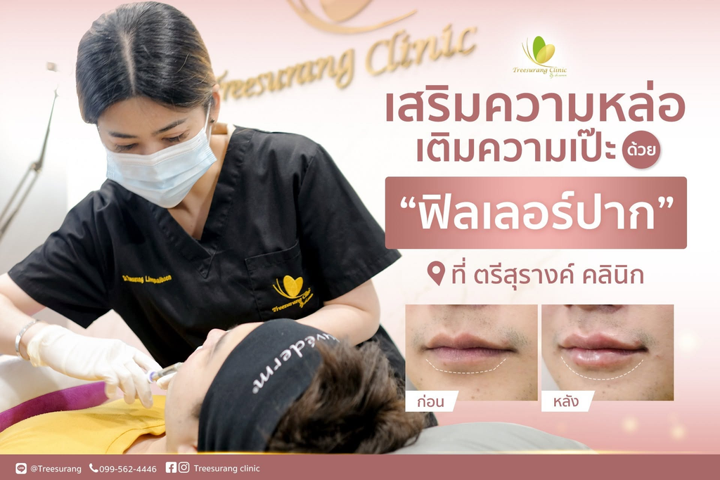 รีวิวฉีดฟิลเลอร์ปากที่ Treesurang Clinic