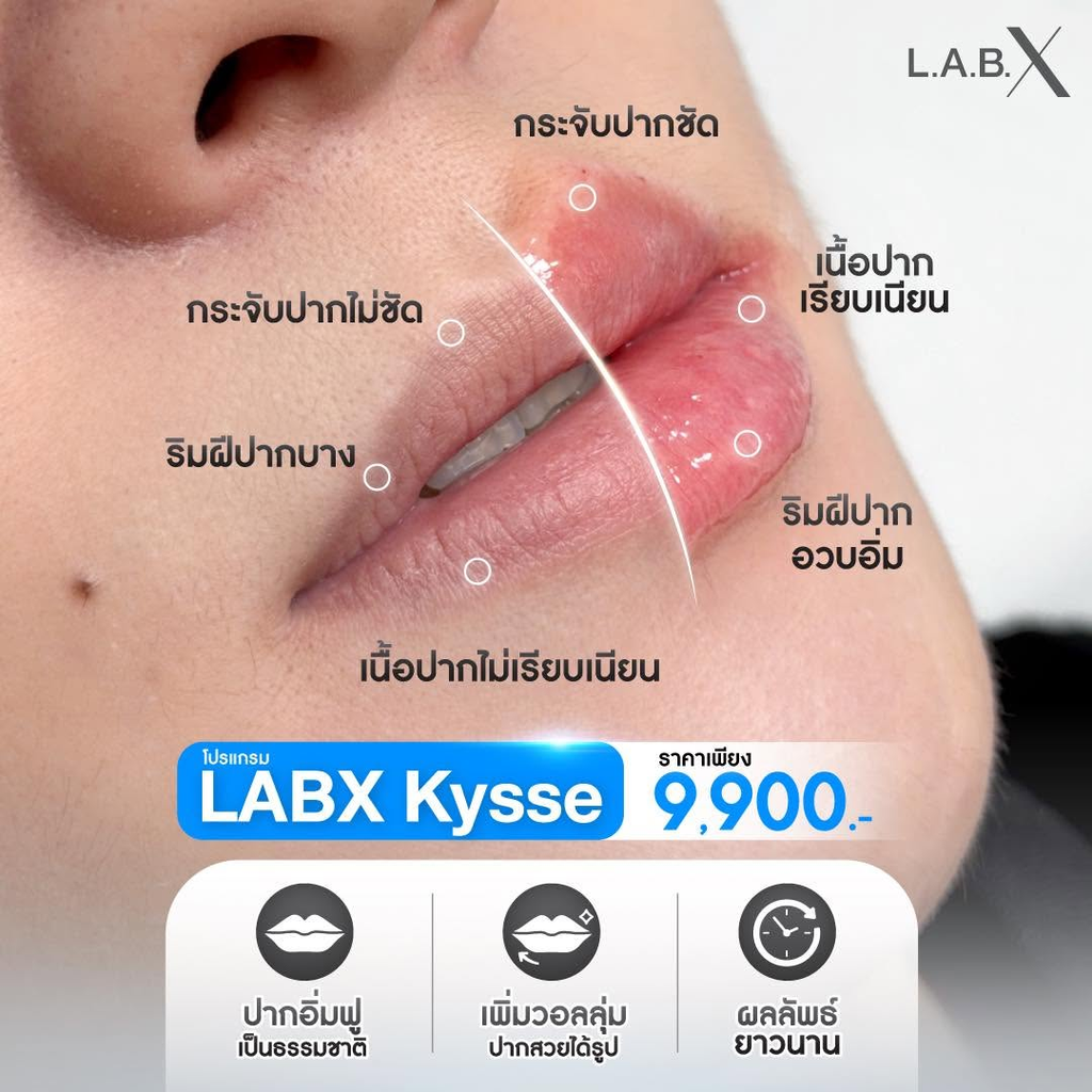 รีวิวฉีดฟิลเลอร์ปากที่ LabX Clinic