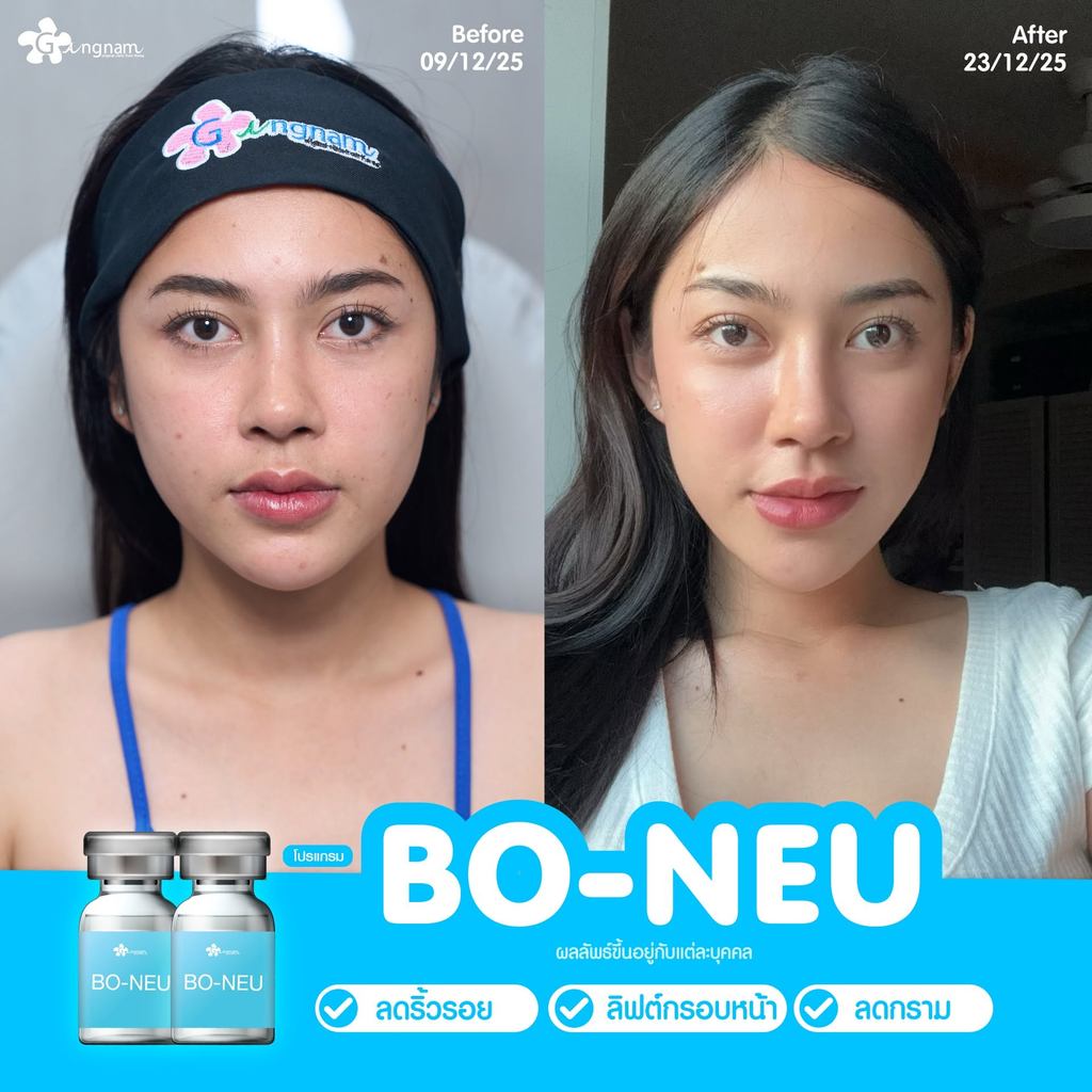 รีวิวคลินิกฉีดโบท็อกซ์โคราชที่ Gangnam Clinic