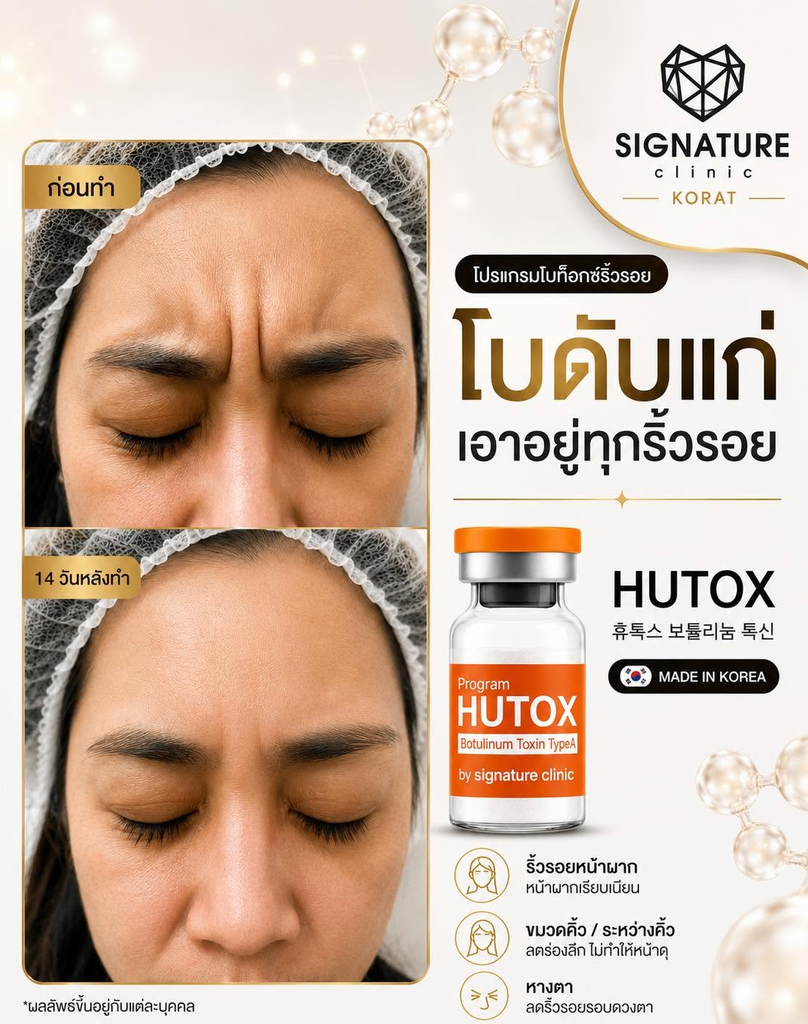 รีวิวคลินิกฉีดโบท็อกซ์โคราชที่ Signature Clinic Korat