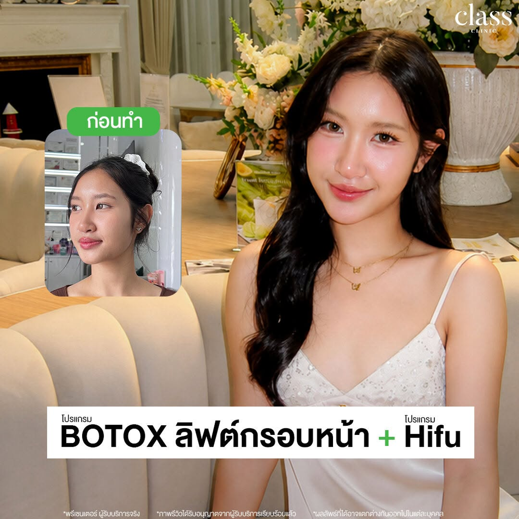 รีวิวคลินิกฉีดโบท็อกซ์โคราชที่ Class Clinic