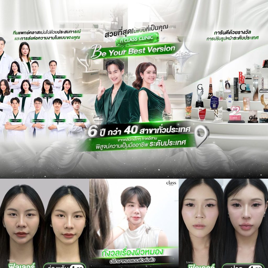 ฉีดฟิลเลอร์โคราชที่ Class Clinic