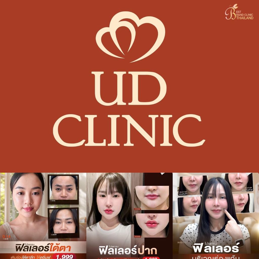 ฉีดฟิลเลอร์โคราชที่ UD Clinic