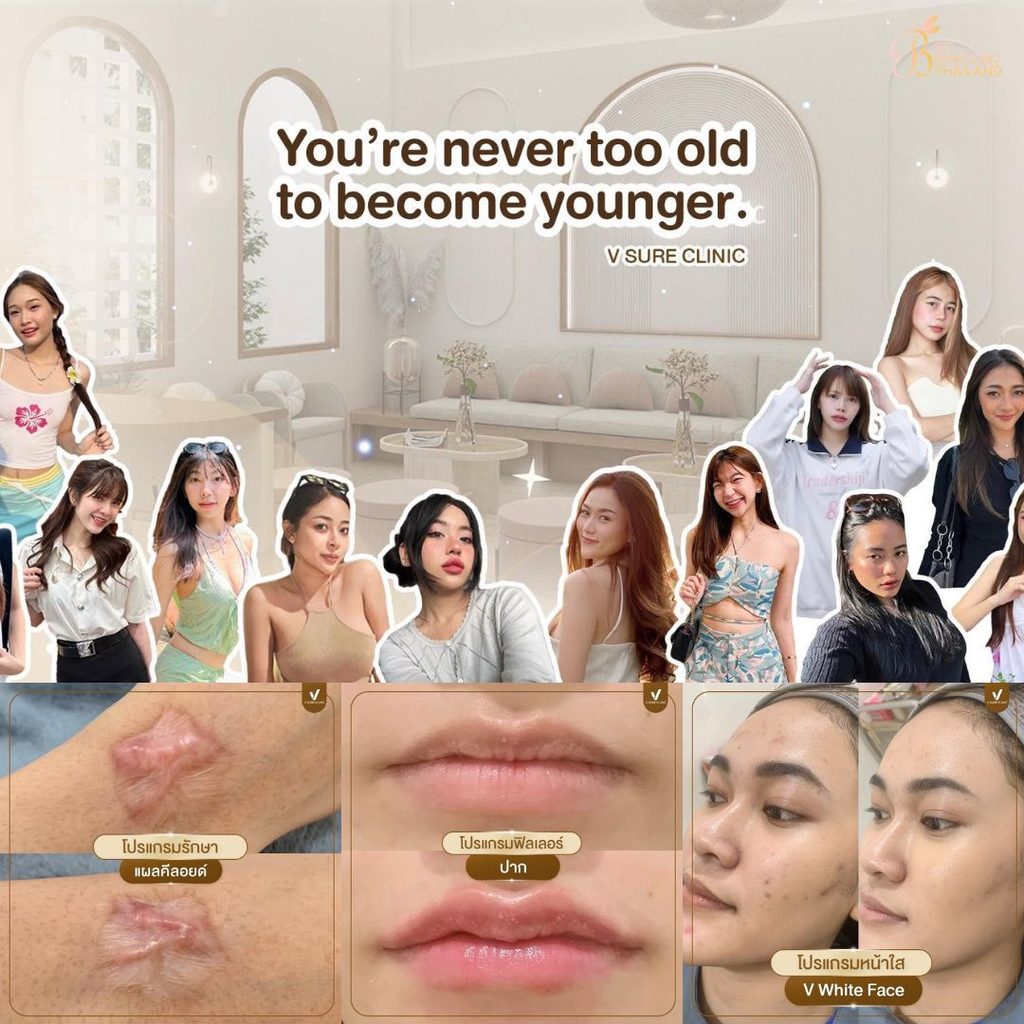 ฉีดฟิลเลอร์โคราชที่ V Sure Clinic