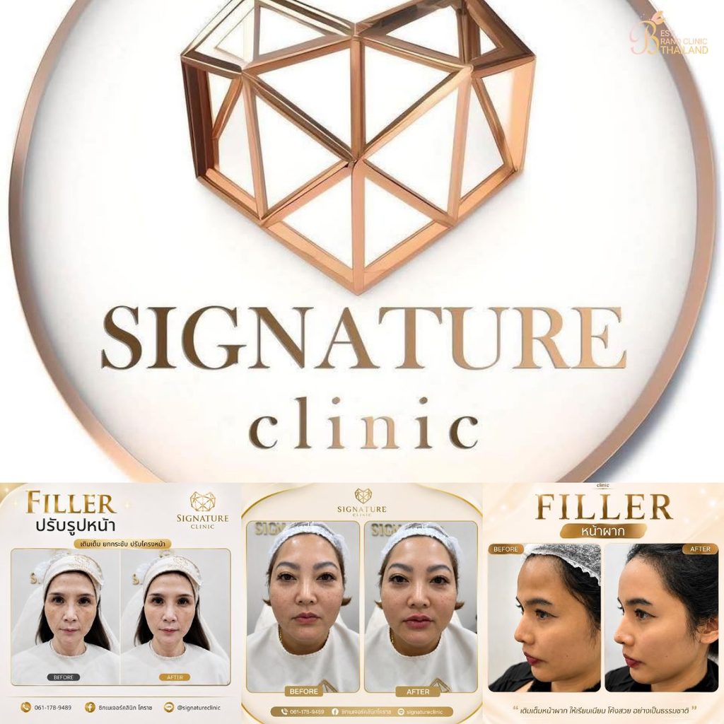 ฉีดฟิลเลอร์โคราชที่ Signature Clinic Korat